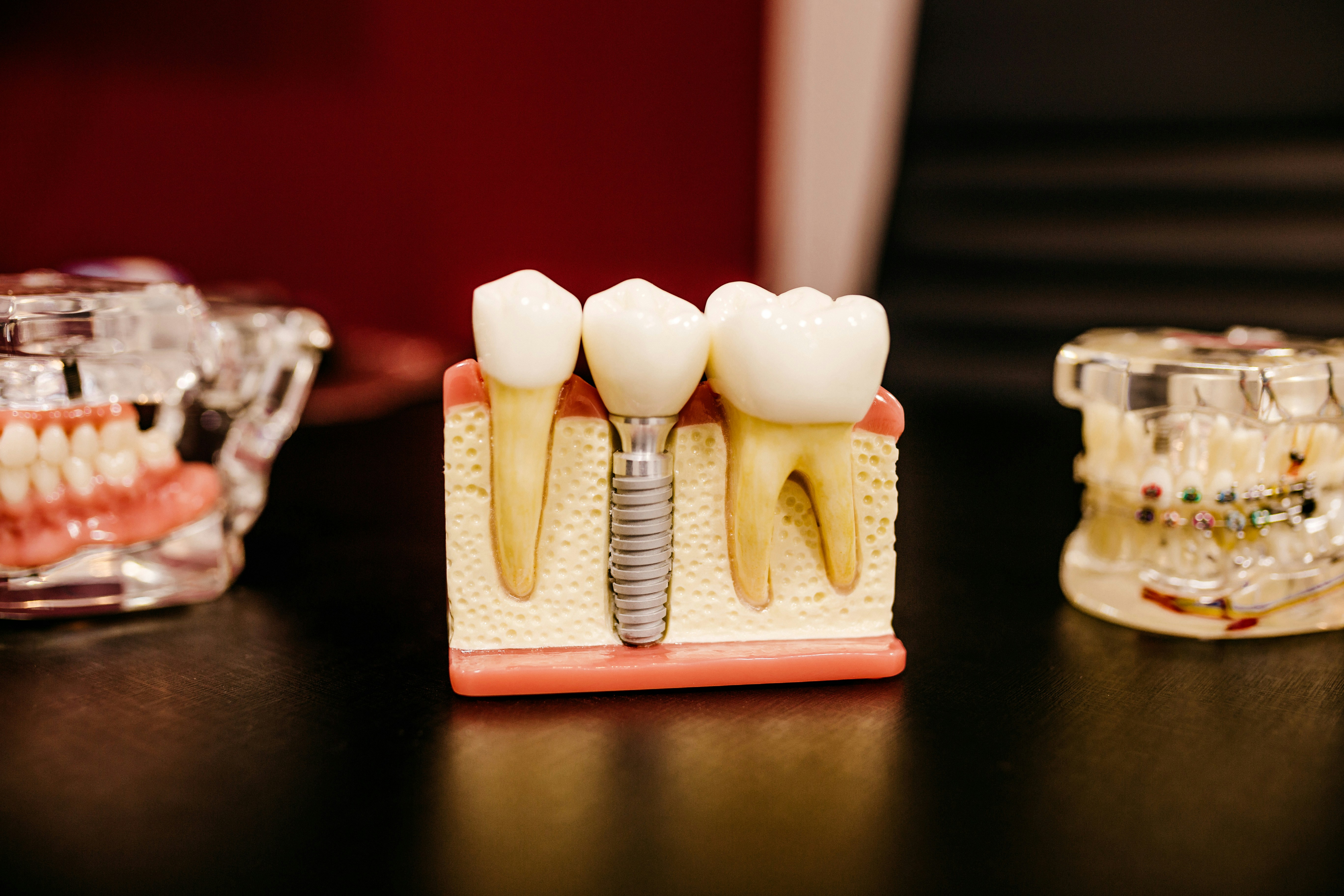 Automedicatie-medicina dentara